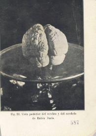 Vista posterior del cerebro y del cerebelo de Rubén Darío
